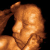 3D ultrasound image of baby’s face in side view