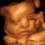 3D ultrasound image of baby with face