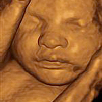 Sepia tone 3D ultrasound picture of baby with face