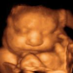 Sepia tone 3D ultrasound image of baby with clear face